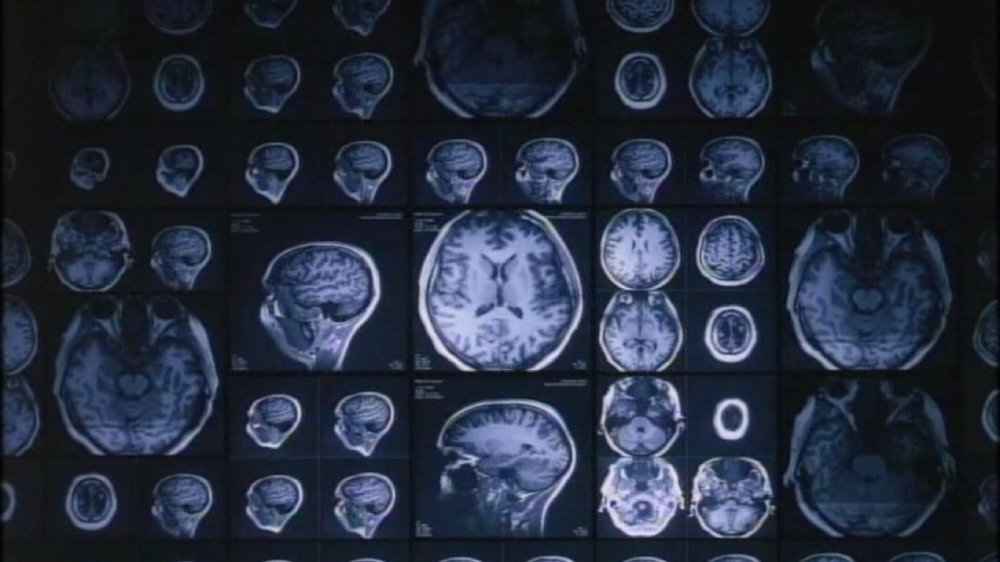 MRI Sequence